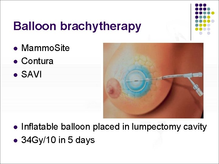 Balloon brachytherapy l l l Mammo. Site Contura SAVI Inflatable balloon placed in lumpectomy