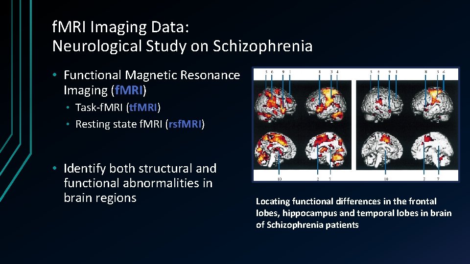 f. MRI Imaging Data: Neurological Study on Schizophrenia • Functional Magnetic Resonance Imaging (f. f. MRI Imaging Data: Neurological Study on Schizophrenia • Functional Magnetic Resonance Imaging (f.