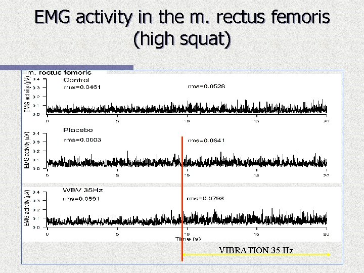 EMG activity in the m. rectus femoris (high squat) VIBRATION 35 Hz 