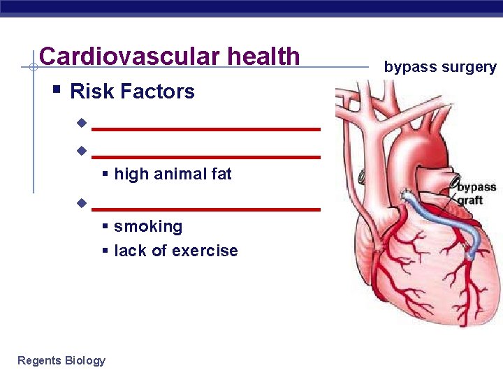 Cardiovascular health § Risk Factors _____________________ u § high animal fat u ___________ §