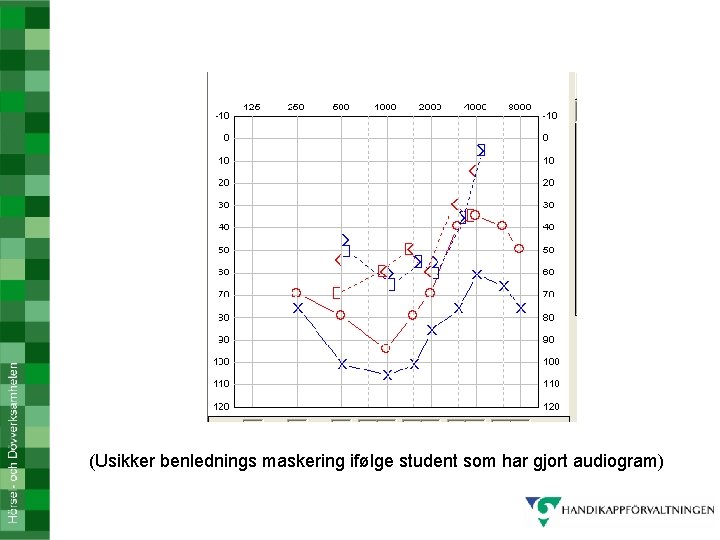 (Usikker benlednings maskering ifølge student som har gjort audiogram) 