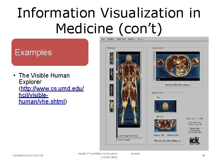 Information Visualization in Medicine (con’t) Examples • The Visible Human Explorer (http: //www. cs. Information Visualization in Medicine (con’t) Examples • The Visible Human Explorer (http: //www. cs.