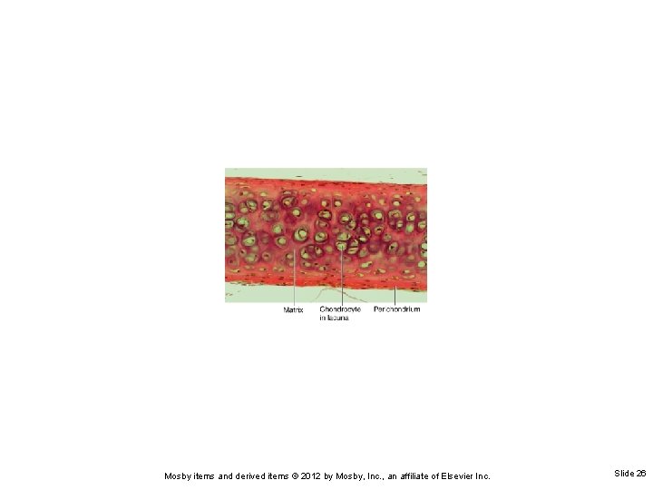 Mosby items and derived items © 2012 by Mosby, Inc. , an affiliate of