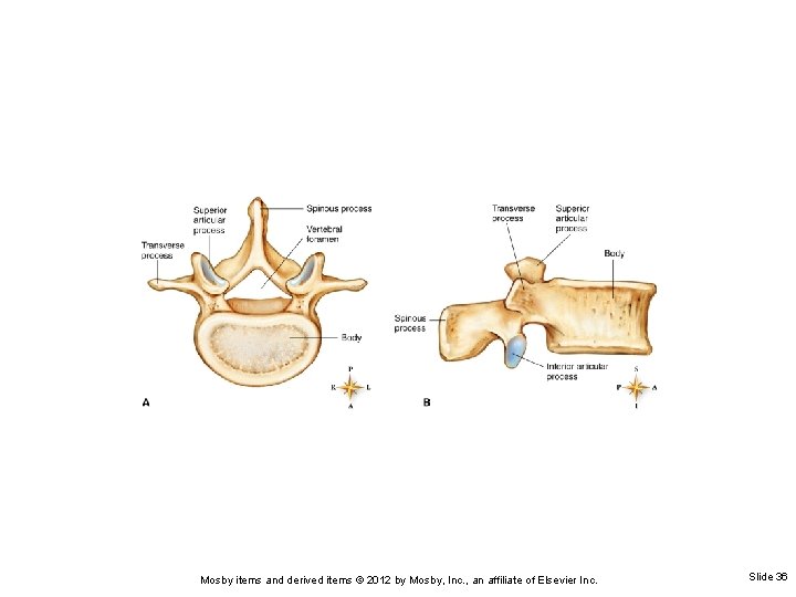 Mosby items and derived items © 2012 by Mosby, Inc. , an affiliate of