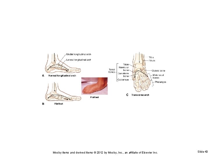 Mosby items and derived items © 2012 by Mosby, Inc. , an affiliate of