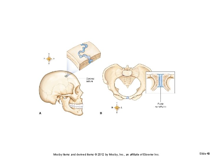 Mosby items and derived items © 2012 by Mosby, Inc. , an affiliate of