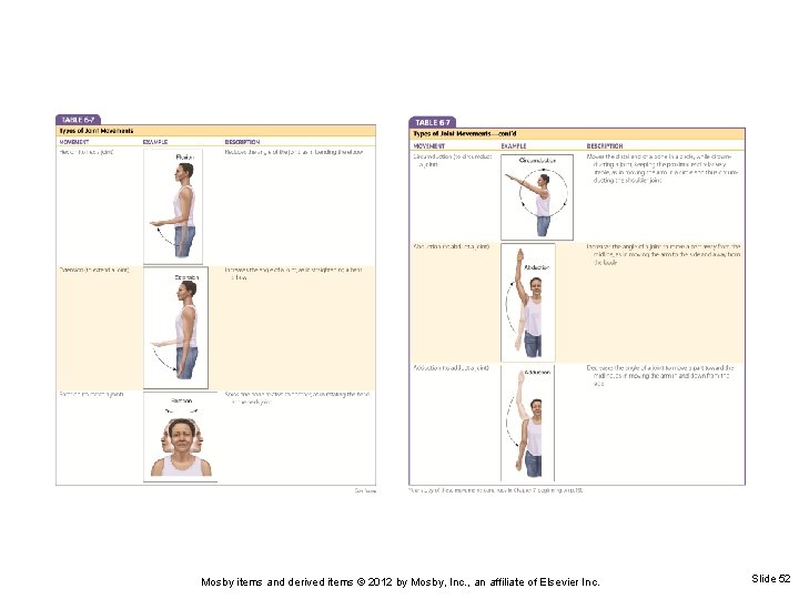 Mosby items and derived items © 2012 by Mosby, Inc. , an affiliate of