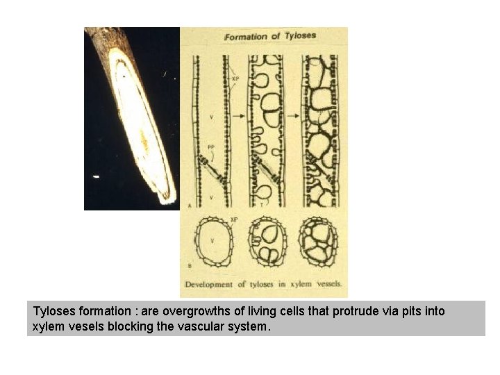 Tyloses formation : are overgrowths of living cells that protrude via pits into xylem