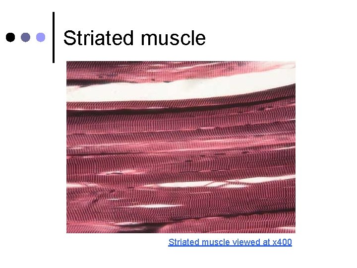 Striated muscle viewed at x 400 