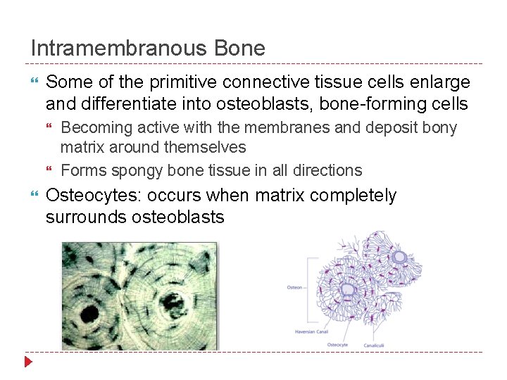 Intramembranous Bone Some of the primitive connective tissue cells enlarge and differentiate into osteoblasts,