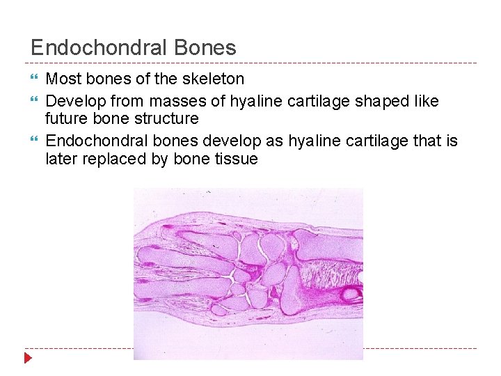 Endochondral Bones Most bones of the skeleton Develop from masses of hyaline cartilage shaped