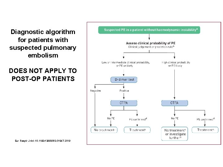 Diagnostic algorithm for patients with suspected pulmonary embolism DOES NOT APPLY TO POST-OP PATIENTS