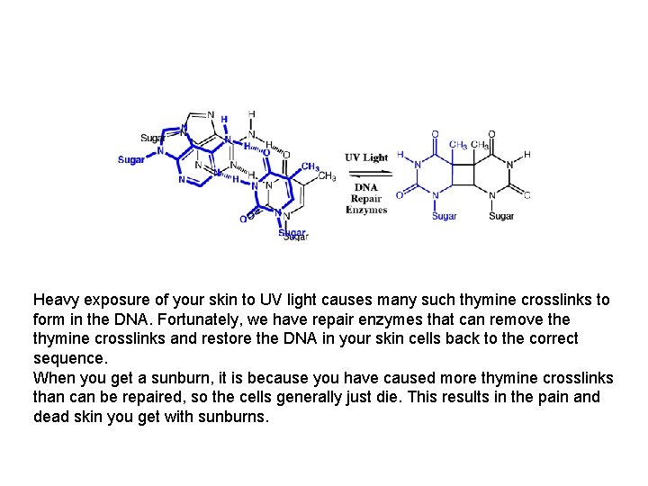 Heavy exposure of your skin to UV light causes many such thymine crosslinks to Heavy exposure of your skin to UV light causes many such thymine crosslinks to