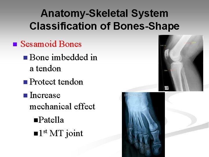 Anatomy-Skeletal System Classification of Bones-Shape n Sesamoid Bones n Bone imbedded in a tendon