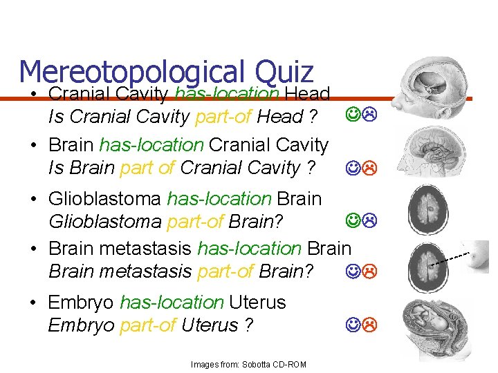 Mereotopological Quiz • Cranial Cavity has-location Head Is Cranial Cavity part-of Head ? •