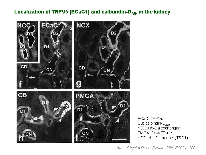 Localization of TRPV 5 (ECa. C 1) and calbundin-D 28 K in the kidney