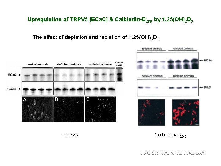 Upregulation of TRPV 5 (ECa. C) & Calbindin-D 28 K by 1, 25(OH)2 D