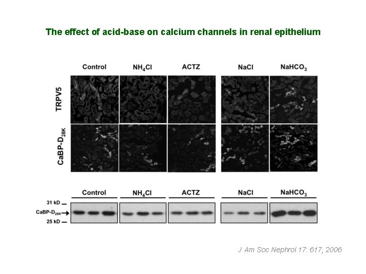 The effect of acid-base on calcium channels in renal epithelium J Am Soc Nephrol