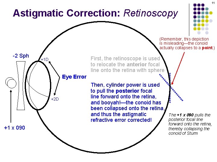 11 Astigmatic Correction: Retinoscopy (Remember, this depiction is misleading—the conoid actually collapses to a