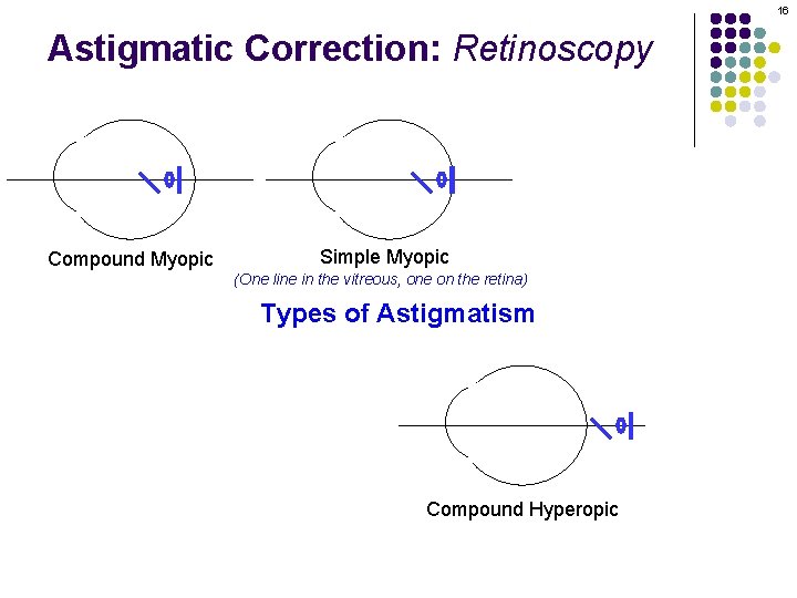 16 Astigmatic Correction: Retinoscopy Compound Myopic Simple Myopic (One line in the vitreous, one