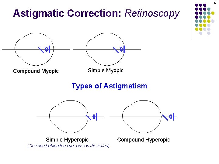17 Astigmatic Correction: Retinoscopy Compound Myopic Simple Myopic Types of Astigmatism Simple Hyperopic (One