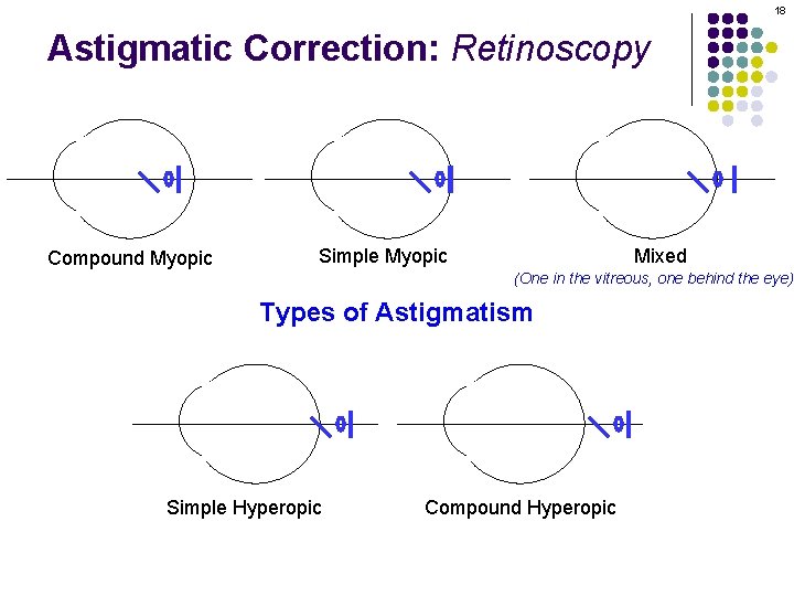 18 Astigmatic Correction: Retinoscopy Compound Myopic Simple Myopic Mixed (One in the vitreous, one