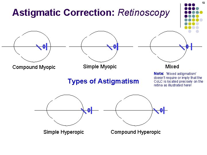 19 Astigmatic Correction: Retinoscopy Compound Myopic Simple Myopic Mixed Note: ‘Mixed astigmatism’ Types of