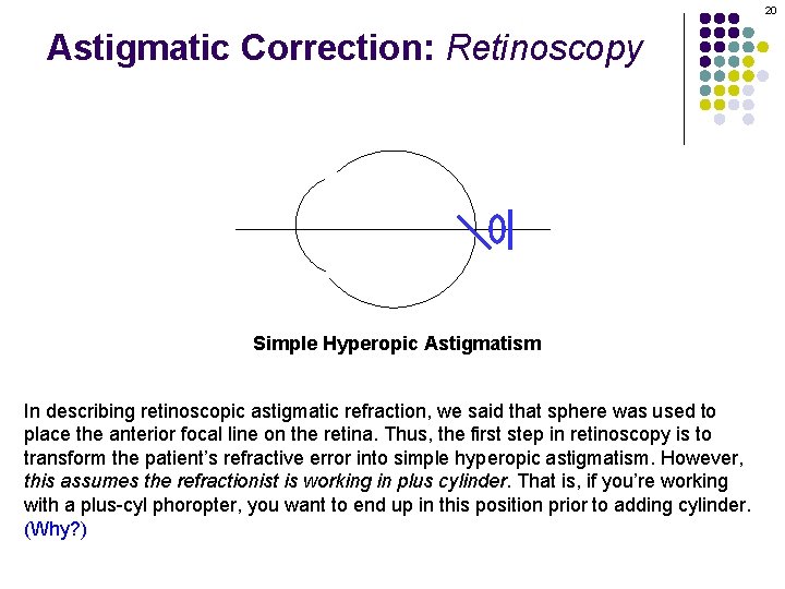 20 Astigmatic Correction: Retinoscopy Simple Hyperopic Astigmatism In describing retinoscopic astigmatic refraction, we said