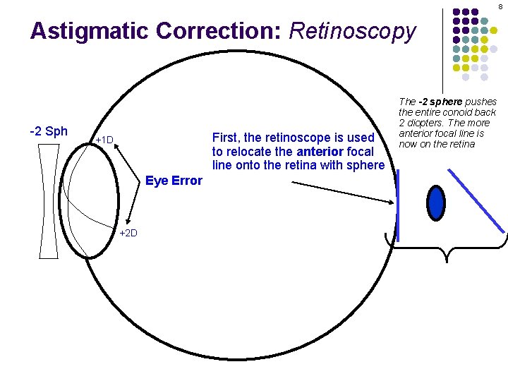 8 Astigmatic Correction: Retinoscopy -2 Sph First, the retinoscope is used to relocate the