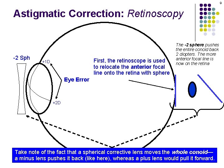 9 Astigmatic Correction: Retinoscopy -2 Sph First, the retinoscope is used to relocate the