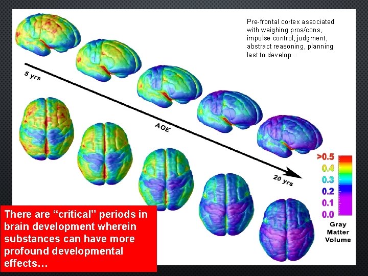 Pre-frontal cortex associated with weighing pros/cons, impulse control, judgment, abstract reasoning, planning last to