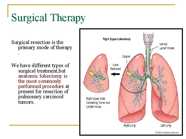 Surgical Therapy Surgical resection is the primary mode of therapy. We have different types