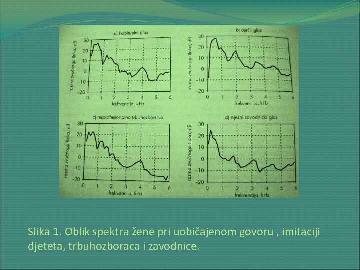 Slika 1. Oblik spektra žene pri uobičajenom govoru , imitaciji djeteta, trbuhozboraca i zavodnice.