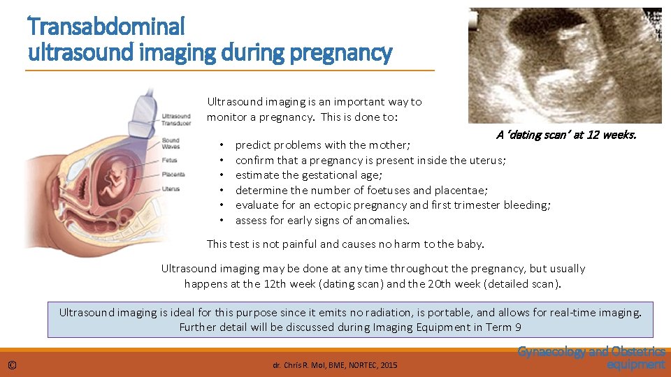 Transabdominal ultrasound imaging during pregnancy Ultrasound imaging is an important way to monitor a