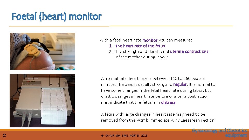 Foetal (heart) monitor With a fetal heart rate monitor you can measure: 1. the