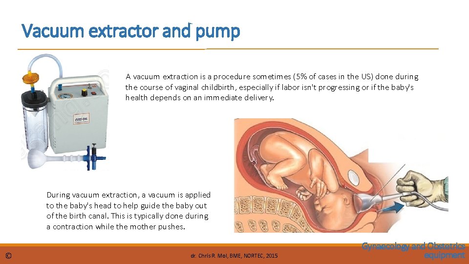 Vacuum extractor and pump A vacuum extraction is a procedure sometimes (5% of cases