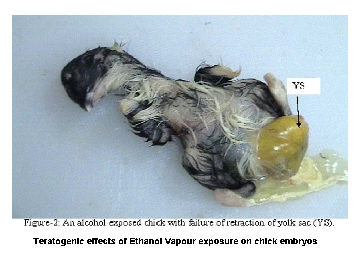 Teratogenic effects of Ethanol Vapour exposure on chick embryos 