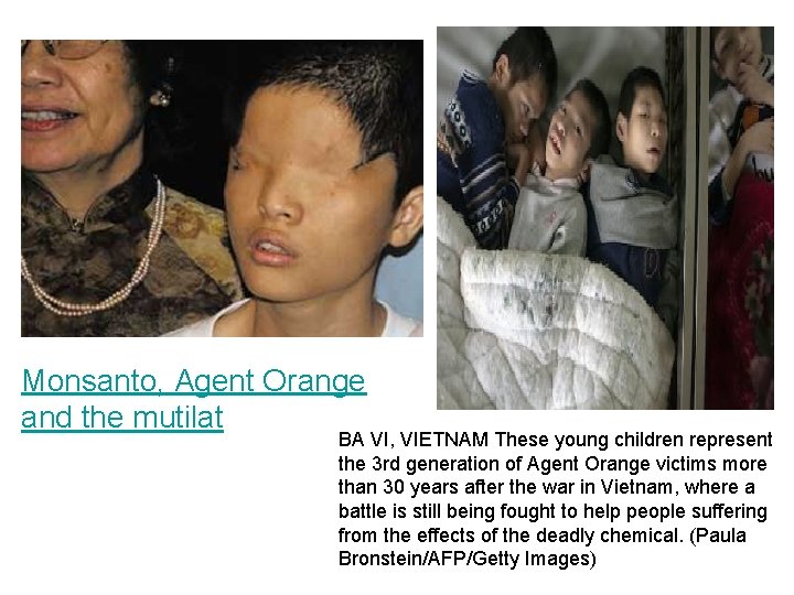 Monsanto, Agent Orange and the mutilat BA VI, VIETNAM These young children represent the