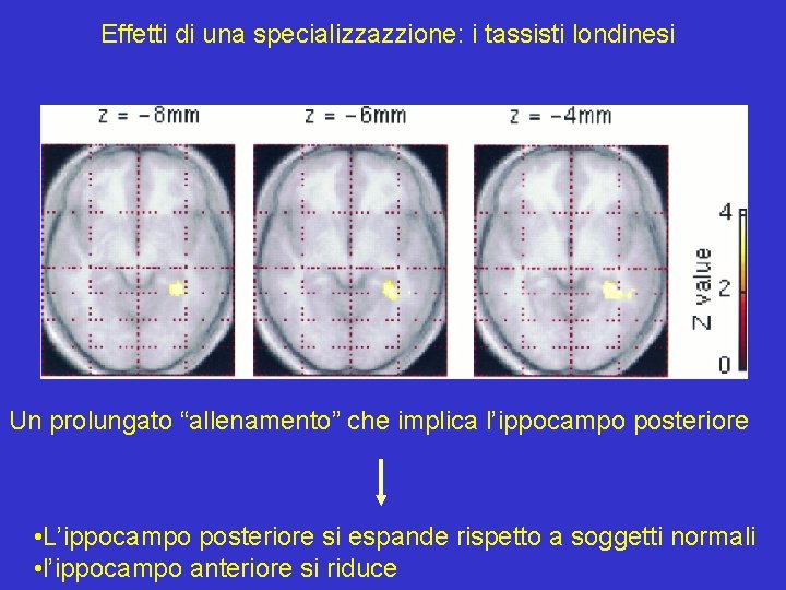 Effetti di una specializzazzione: i tassisti londinesi Un prolungato “allenamento” che implica l’ippocampo posteriore