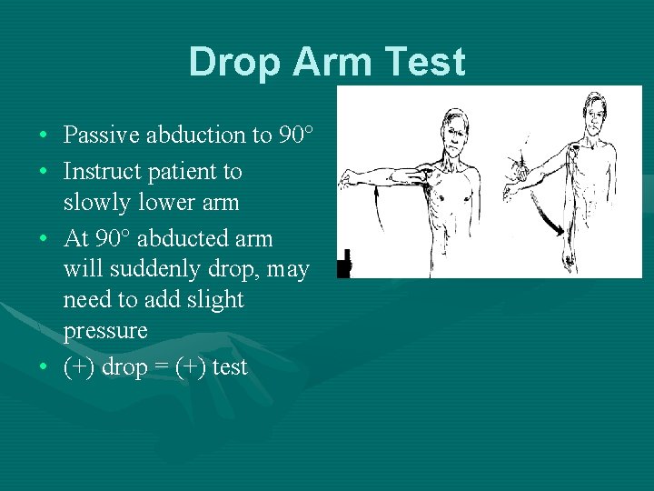 Drop Arm Test • Passive abduction to 90° • Instruct patient to slowly lower
