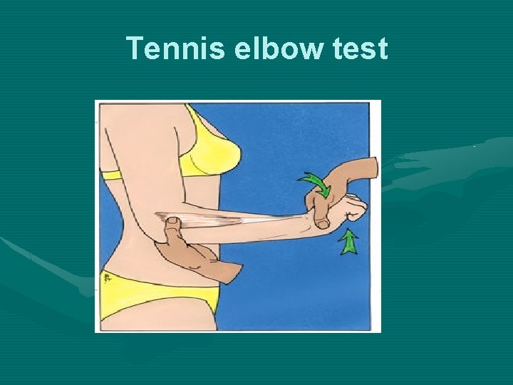 Tennis elbow test 