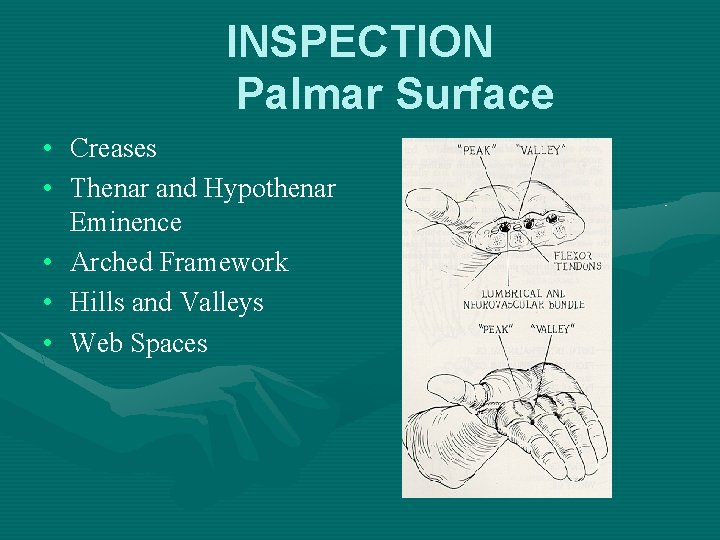 INSPECTION Palmar Surface • Creases • Thenar and Hypothenar Eminence • Arched Framework •
