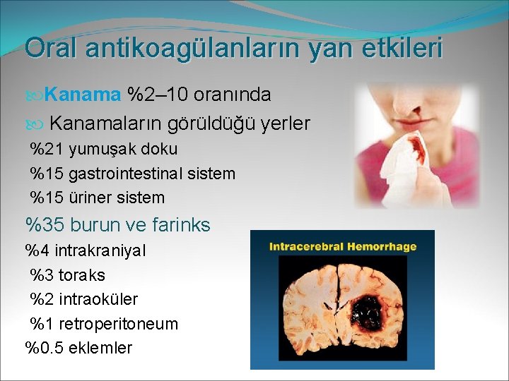 Oral antikoagülanların yan etkileri Kanama %2– 10 oranında Kanamaların görüldüğü yerler %21 yumuşak doku