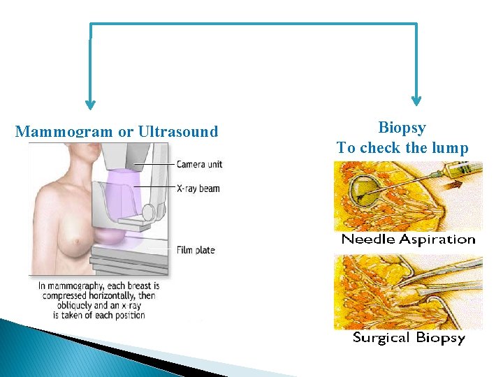 Mammogram or Ultrasound Biopsy To check the lump 
