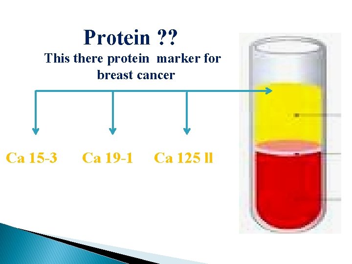 Protein ? ? This there protein marker for breast cancer Ca 15 -3 Ca