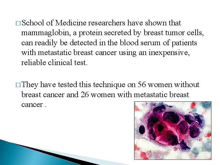 � School of Medicine researchers have shown that mammaglobin, a protein secreted by breast