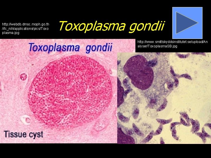 http: //webdb. dmsc. moph. go. th /ifc_nih/applications/pics/Toxo plasma. jpg Toxoplasma gondii http: //www. smittskyddsinstitutet.