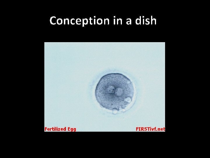 Conception in a dish 