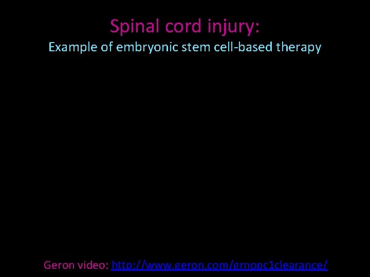 Spinal cord injury: Example of embryonic stem cell-based therapy Geron video: http: //www. geron.