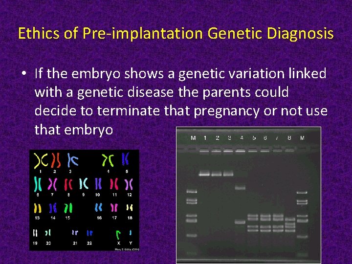 Ethics of Pre-implantation Genetic Diagnosis • If the embryo shows a genetic variation linked